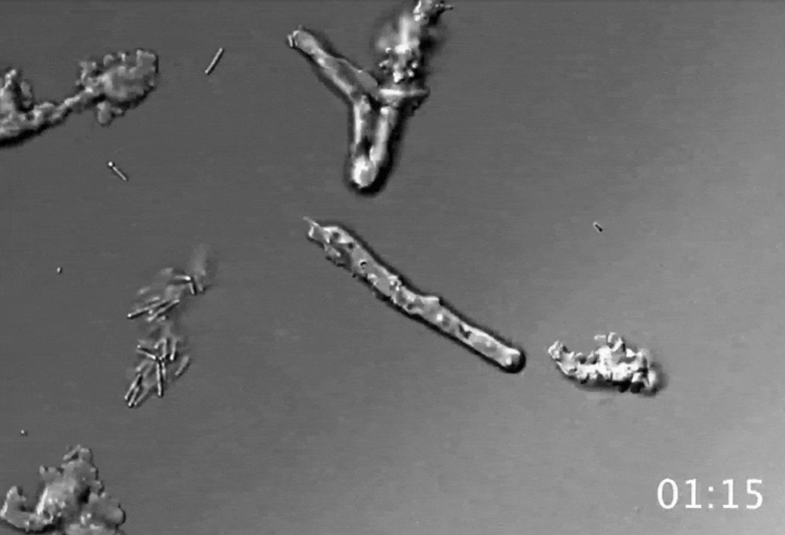 Newly discovered ‘fire amoeba’ pushes the boundaries of life on Earth