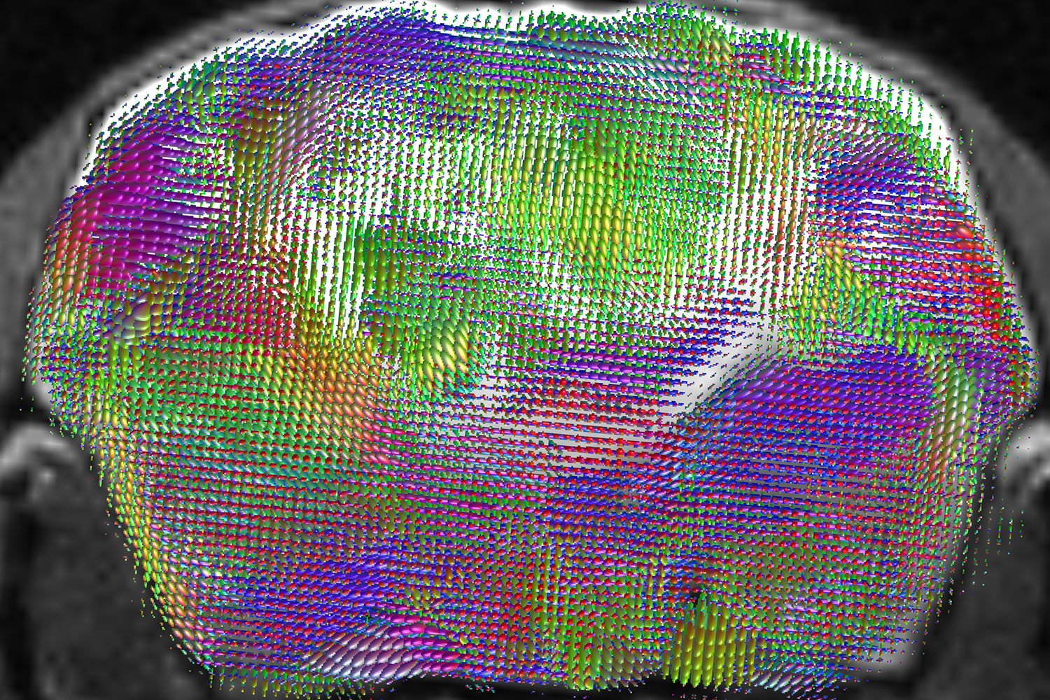 Researchers create advanced model for studying brain development, disorders